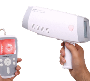 MobiLab Handheld Video Colposcope